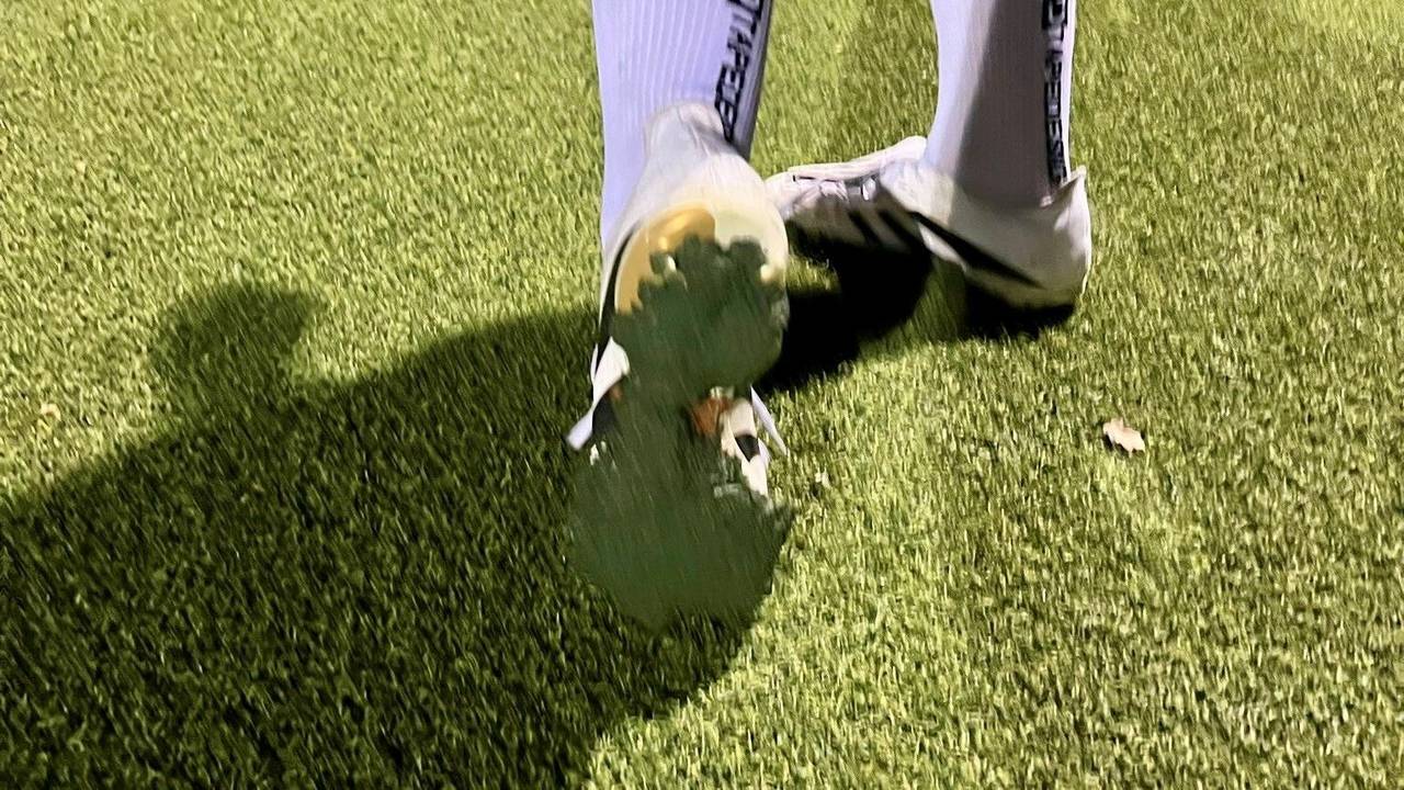 Auf mehreren Kölner Kunstrasenplätzen bleibt das Granulat den Spielern an den Schuhen pappen.