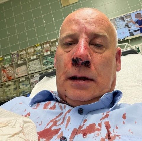 Wachmann Sacha Sturm liegt nach einem Angriff in Köln-Porz im Krankenhaus. Inzwischen konnte der 51-Jährige die Klinik wieder verlassen.
