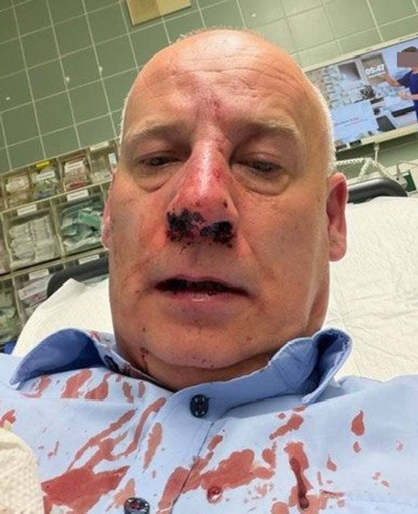 Wachmann Sacha Sturm liegt nach einem Angriff in Köln-Porz im Krankenhaus. Inzwischen konnte der 51-Jährige die Klinik wieder verlassen.