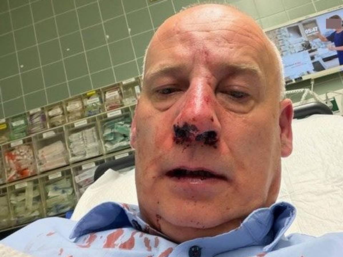 Wachmann Sacha Sturm liegt nach einem Angriff in Köln-Porz im Krankenhaus. Inzwischen konnte der 51-Jährige die Klinik wieder verlassen.