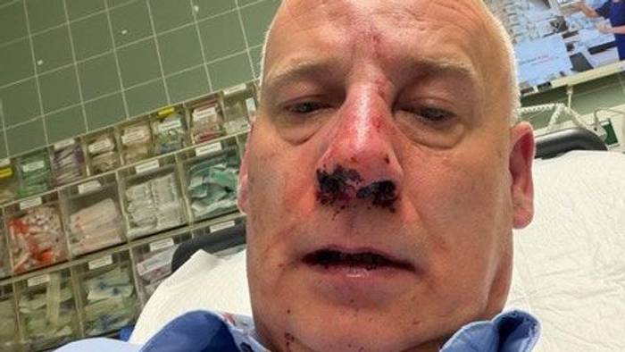Wachmann Sacha Sturm liegt nach einem Angriff in Köln-Porz im Krankenhaus. Inzwischen konnte der 51-Jährige die Klinik wieder verlassen.