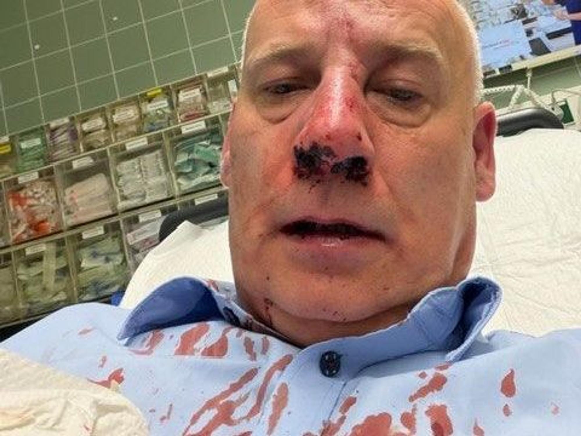 Wachmann Sacha Sturm liegt nach einem Angriff in Köln-Porz im Krankenhaus. Inzwischen konnte der 51-Jährige die Klinik wieder verlassen.