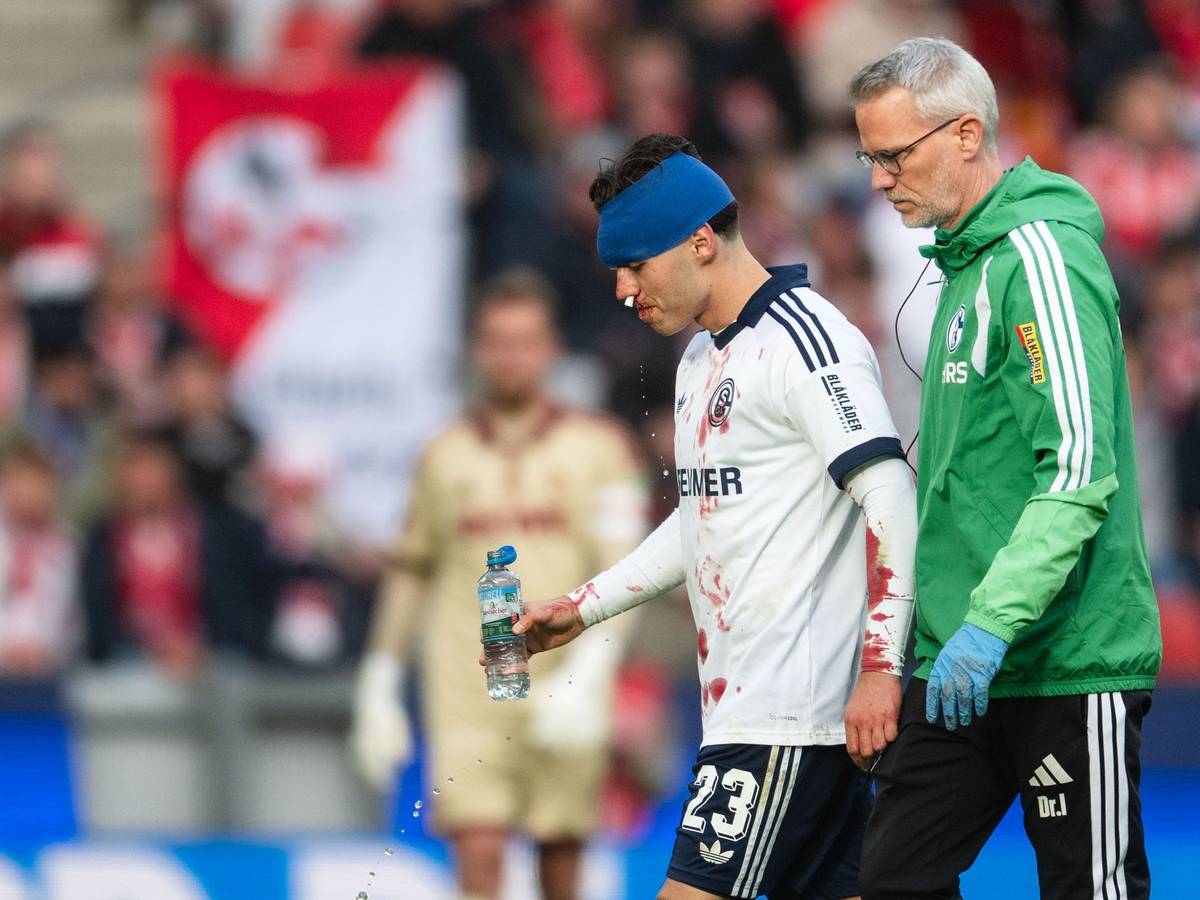 Soufiane El-Faouzi musste blutend vom Platz.