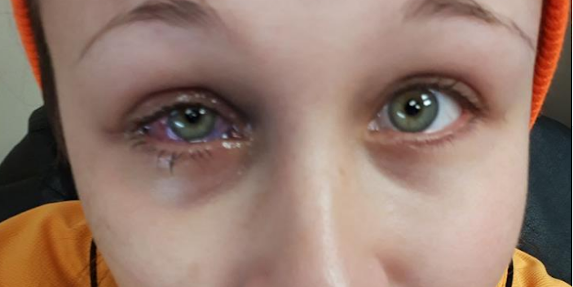 Model_Catt_Gallinger