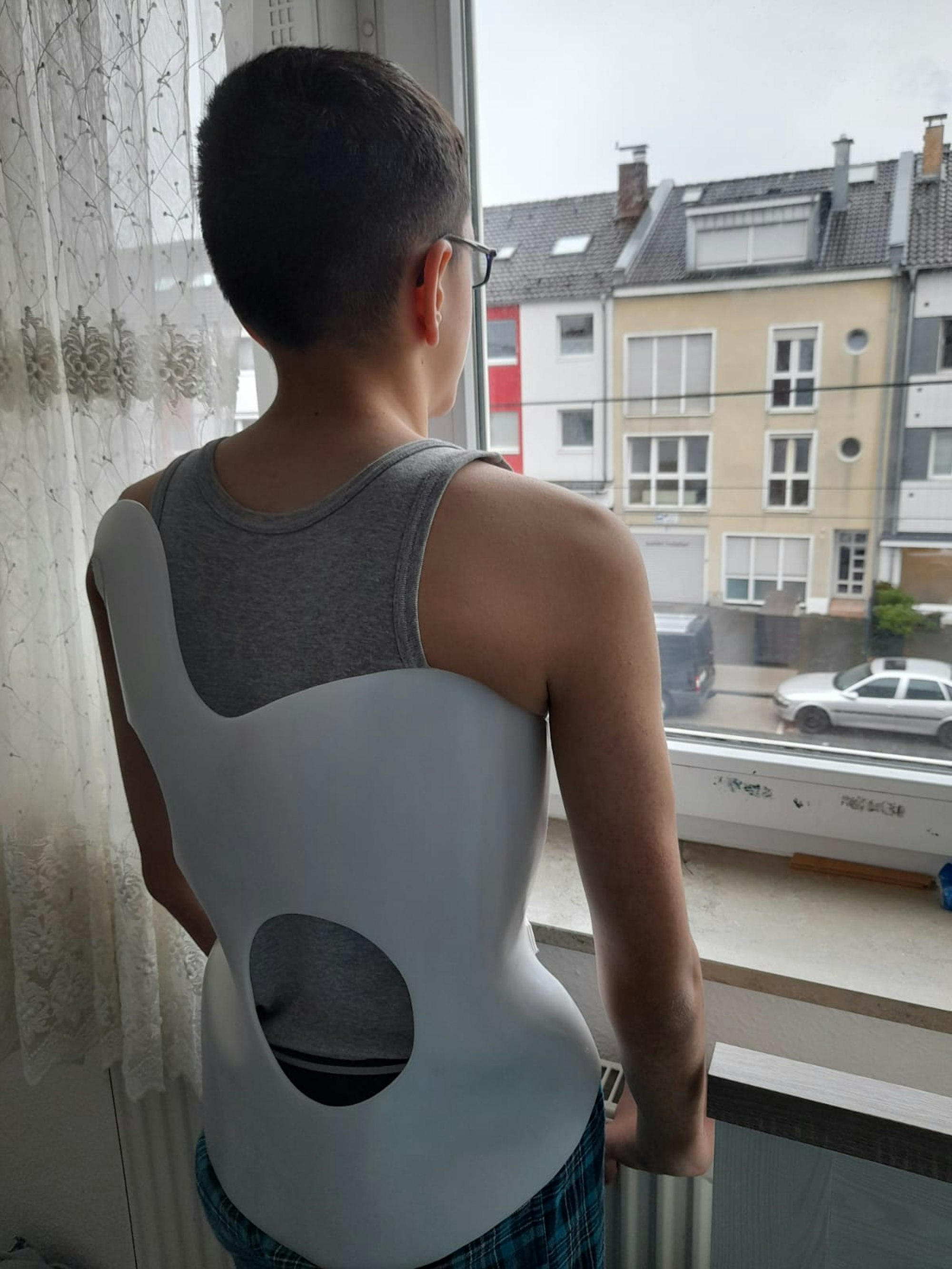 enes_baysöz_skoliose_03_12_2020_04