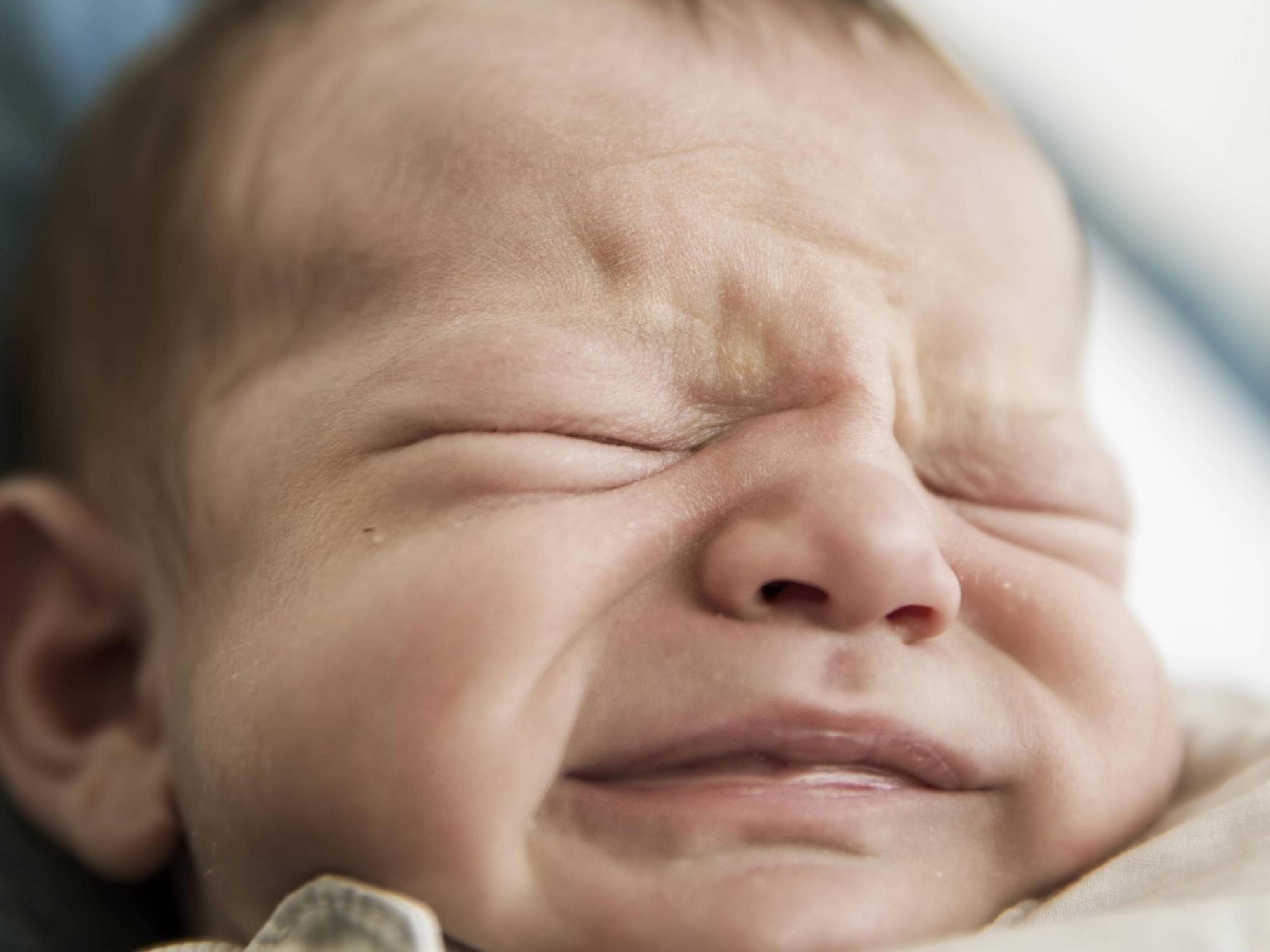 Baby mit zerknautschtem Gesicht.