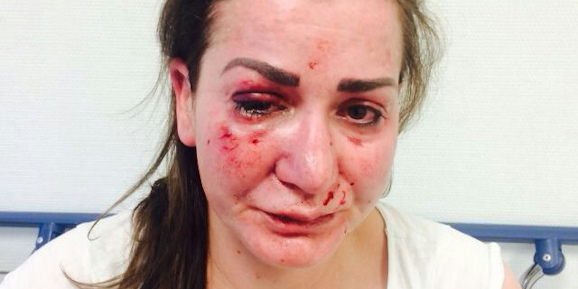 Hacer_Ugurlu_Angriff_KVB_Linie_4_31_10_2018