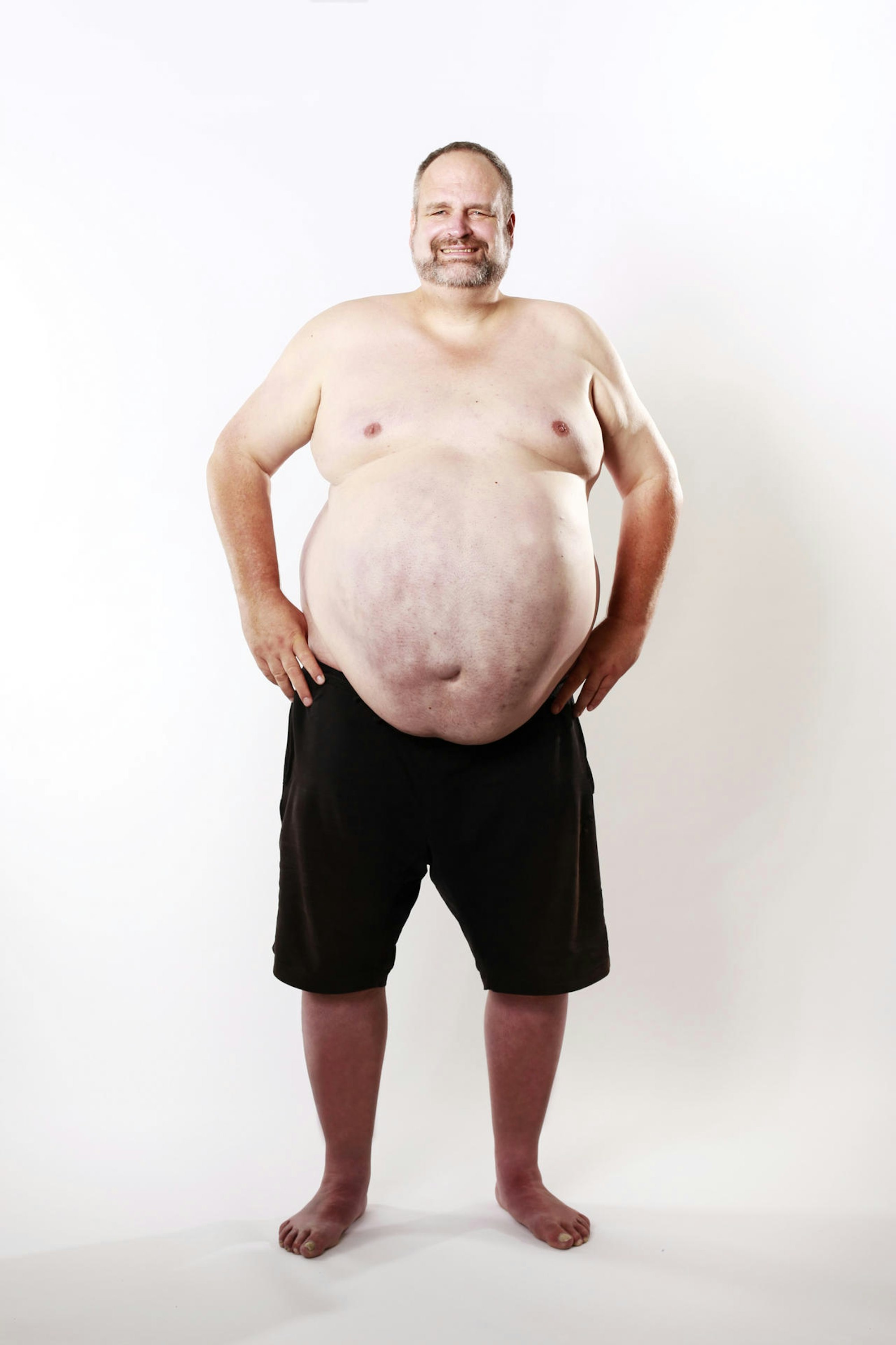 Biggest_Loser_Markus (1)