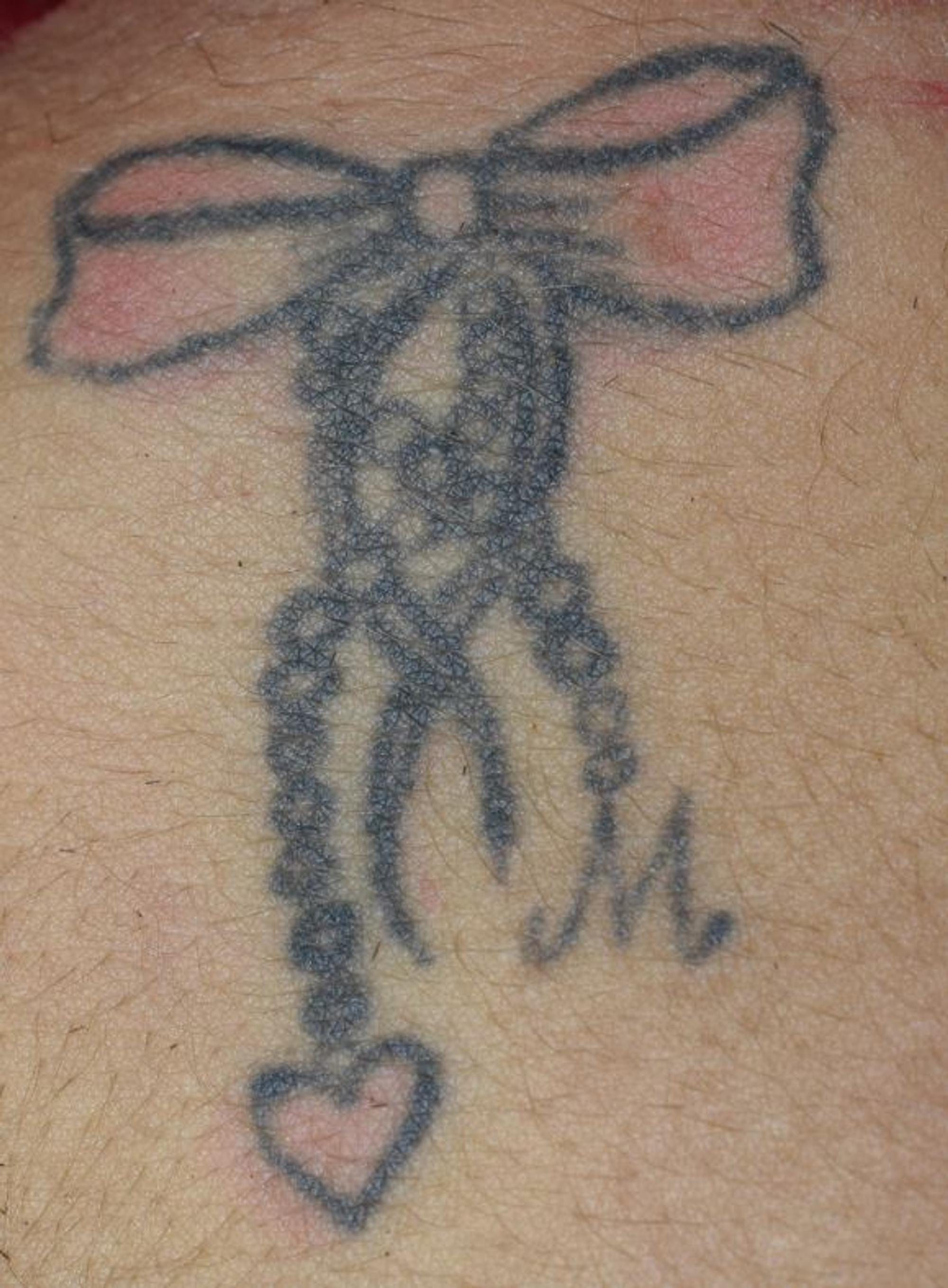 Tattoo1
