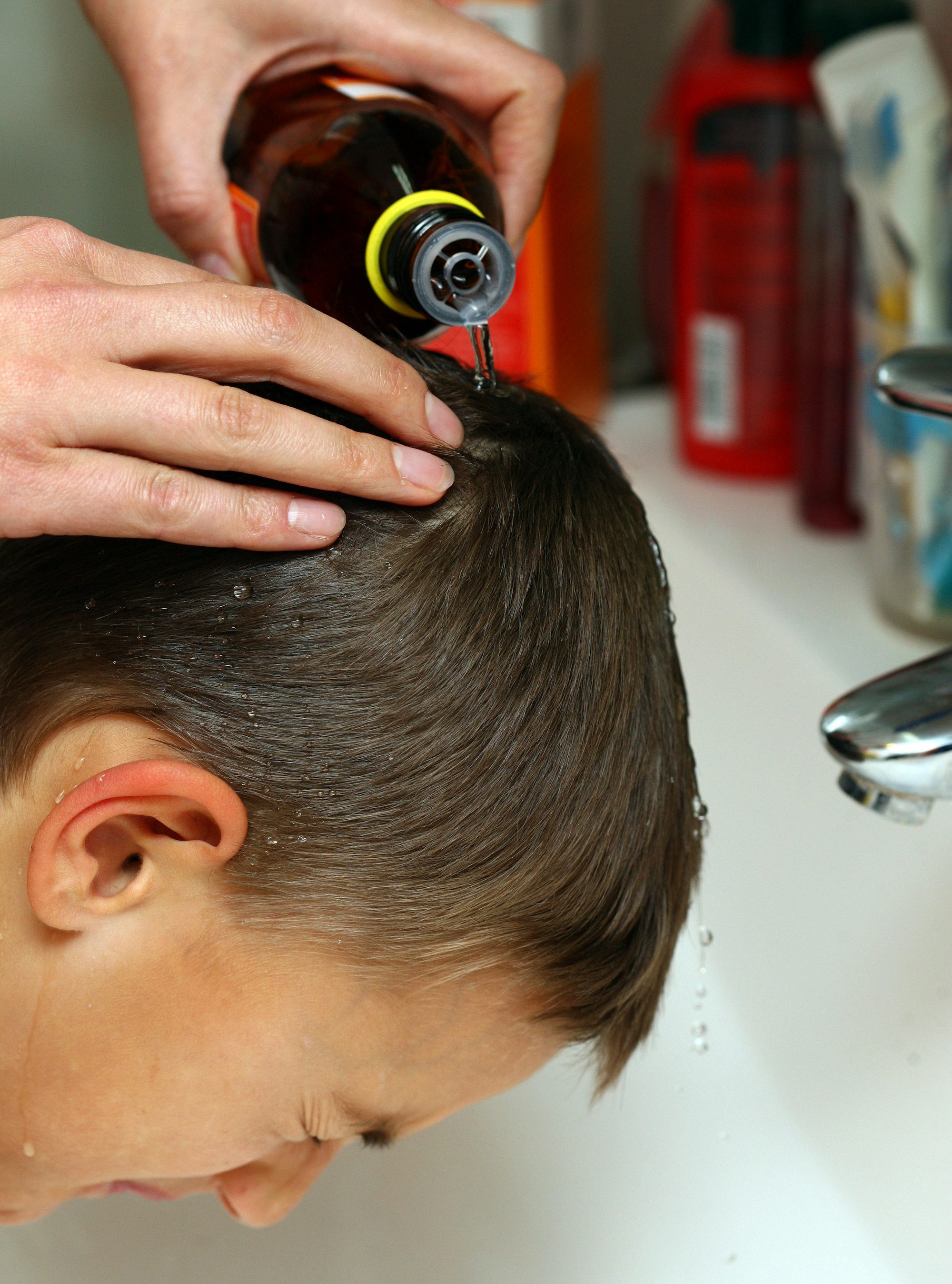 kopf laeusemittel behandlung dpa