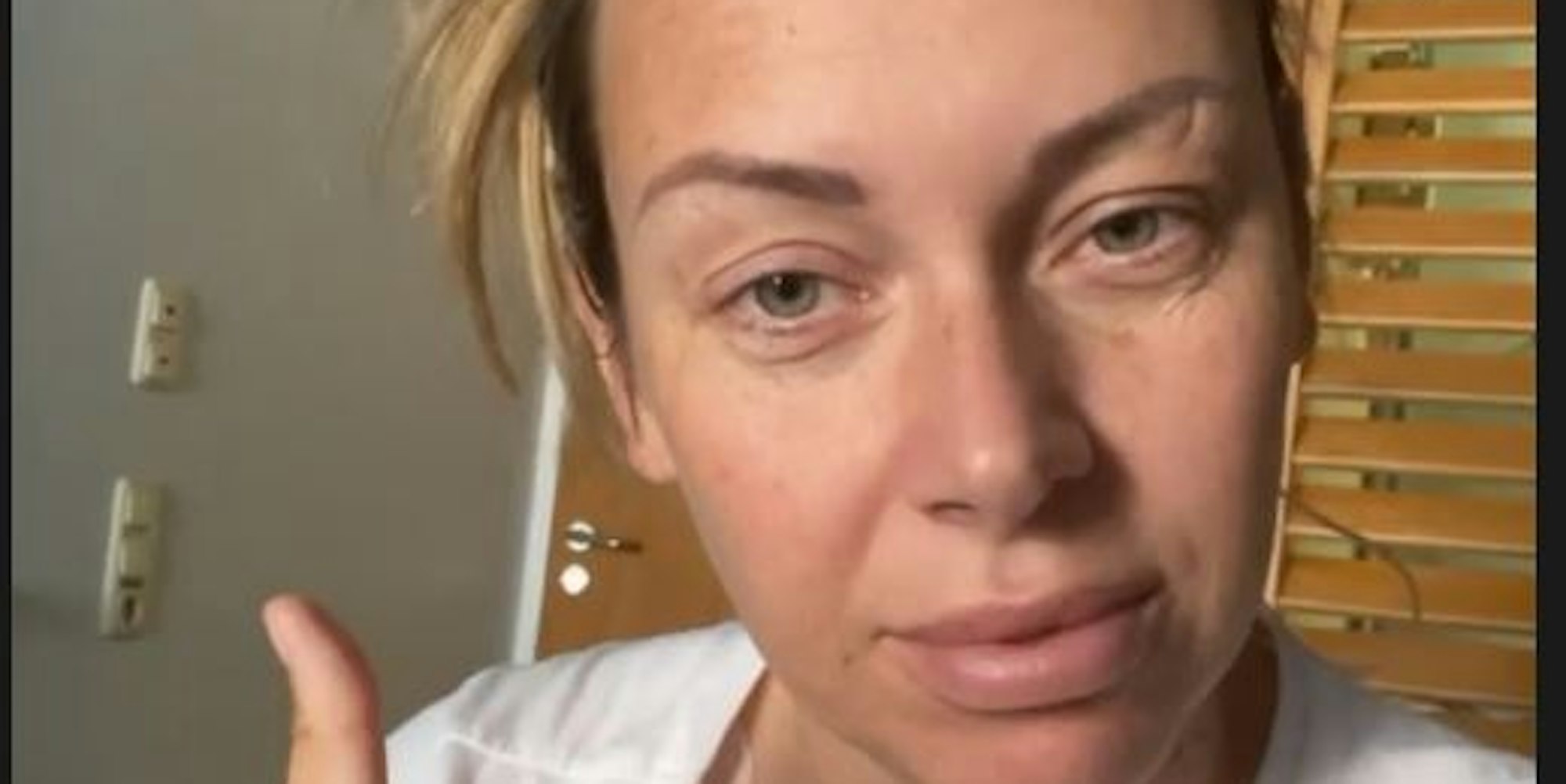 Julia Holz gibt Tage nach Krebs-OP Daumen hoch