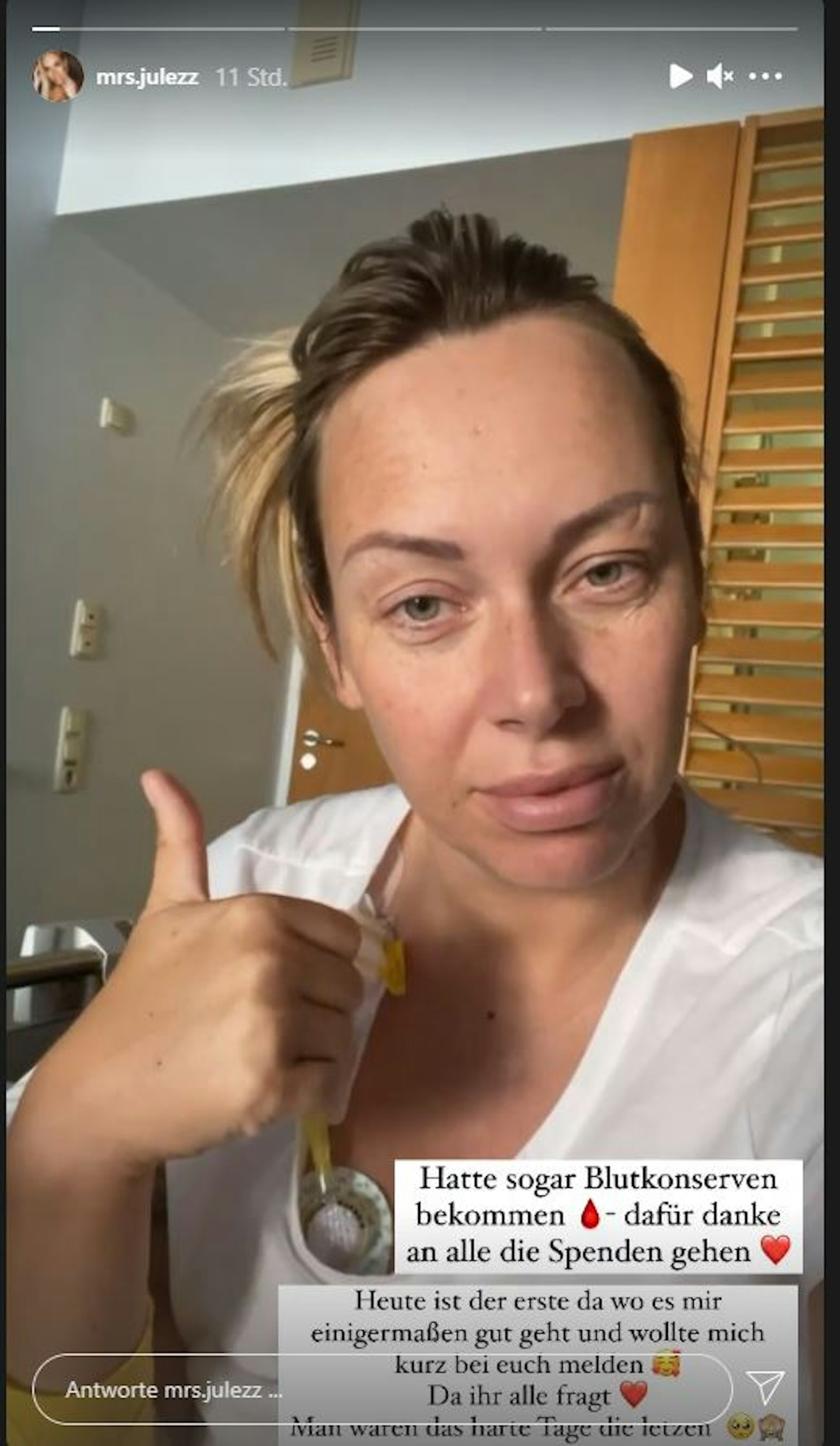 Julia Holz gibt Tage nach Krebs-OP Daumen hoch