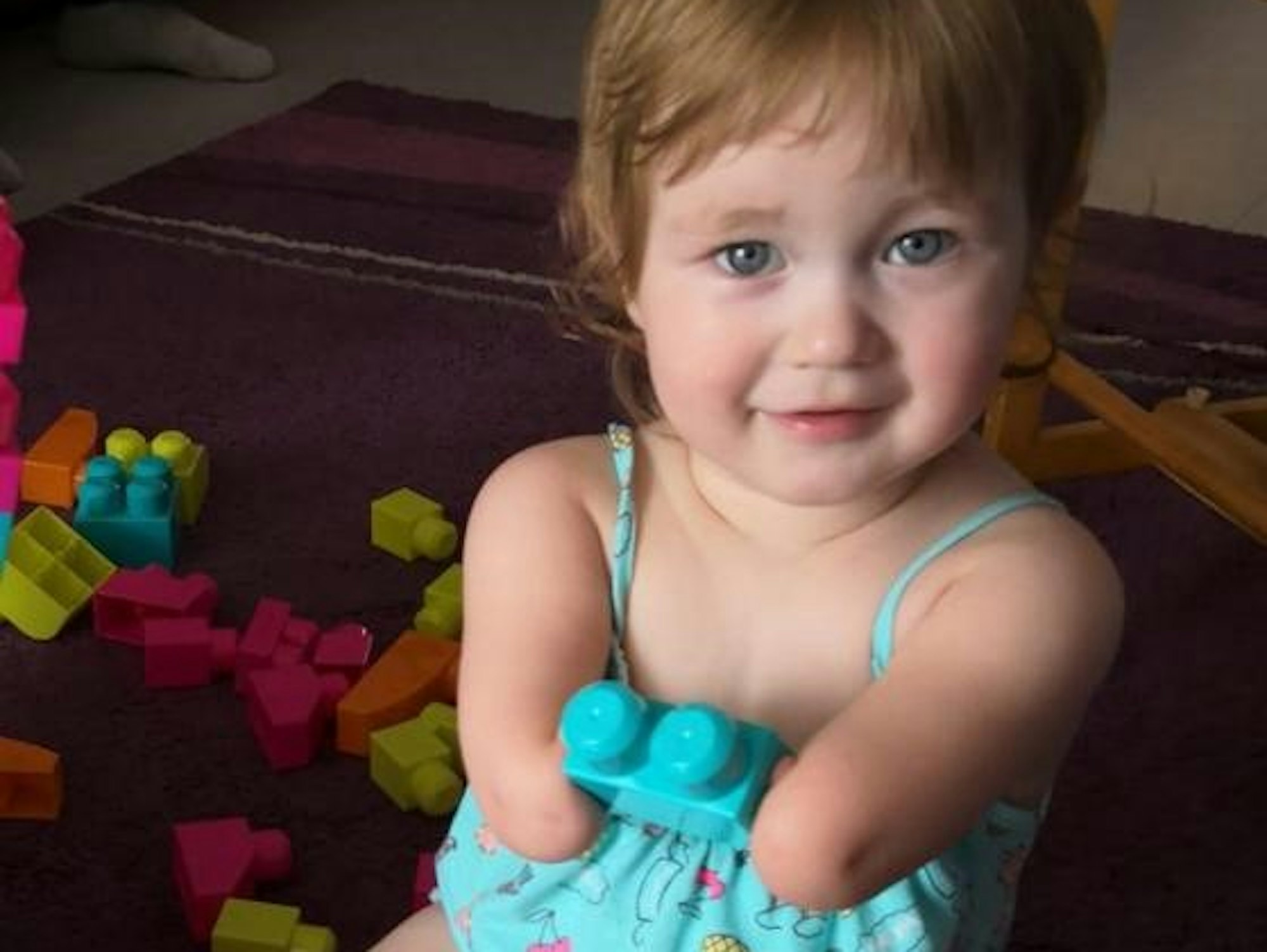 Dysmelie_Familie_Tochter_Milana_Baukloetze