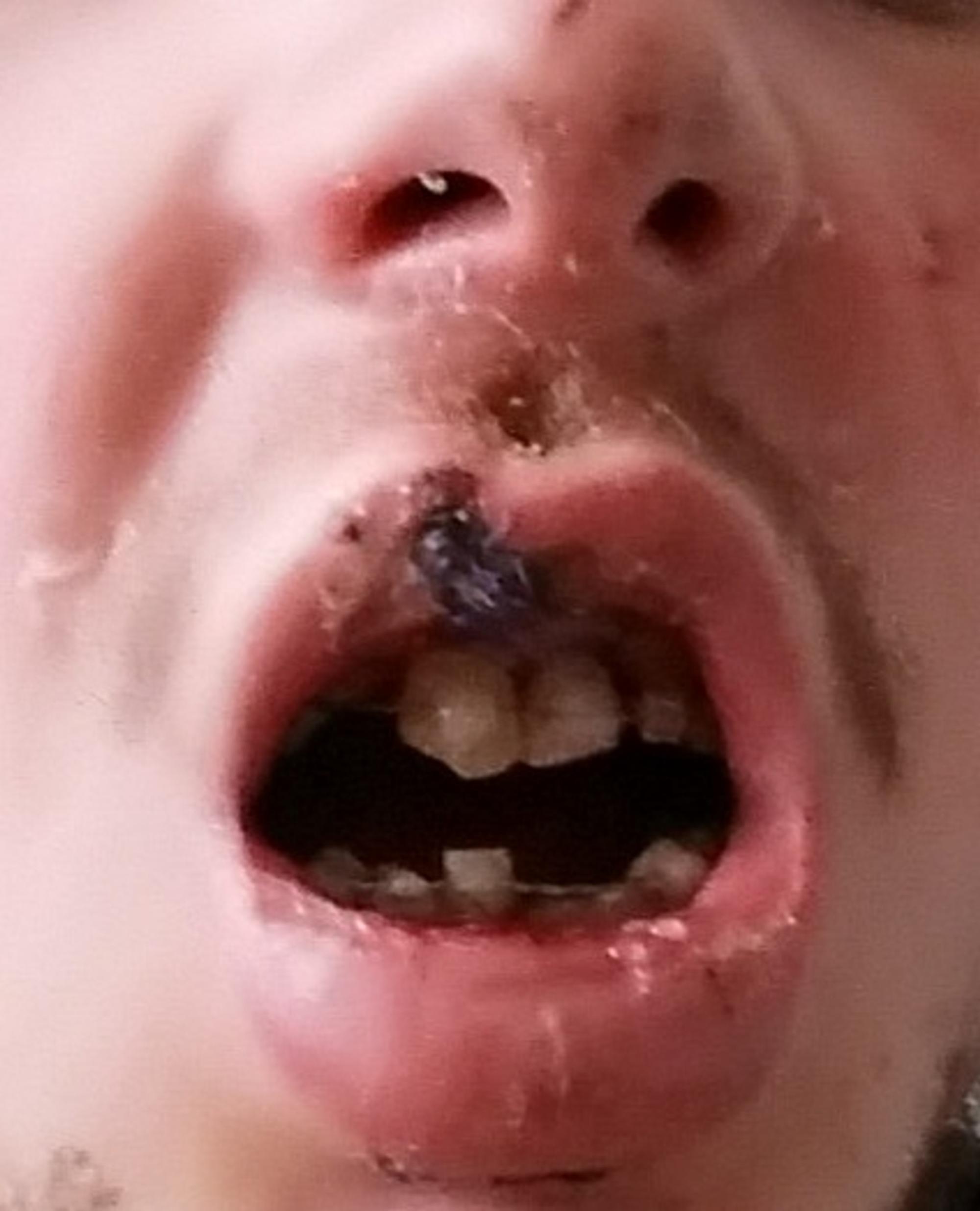 e_zig_explodiert