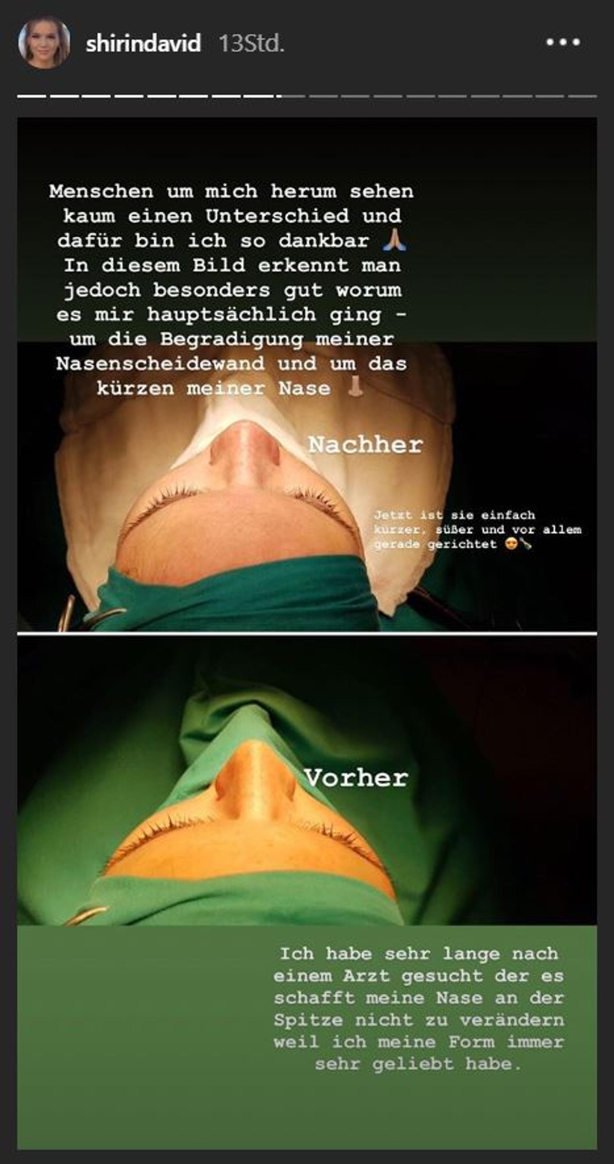 Shirin_David_Nase_OP_story2