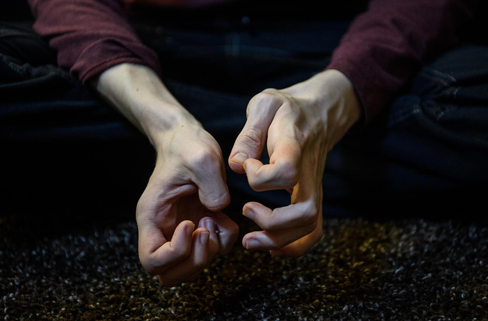 Autismus_verkrampfte_Hände_Finger