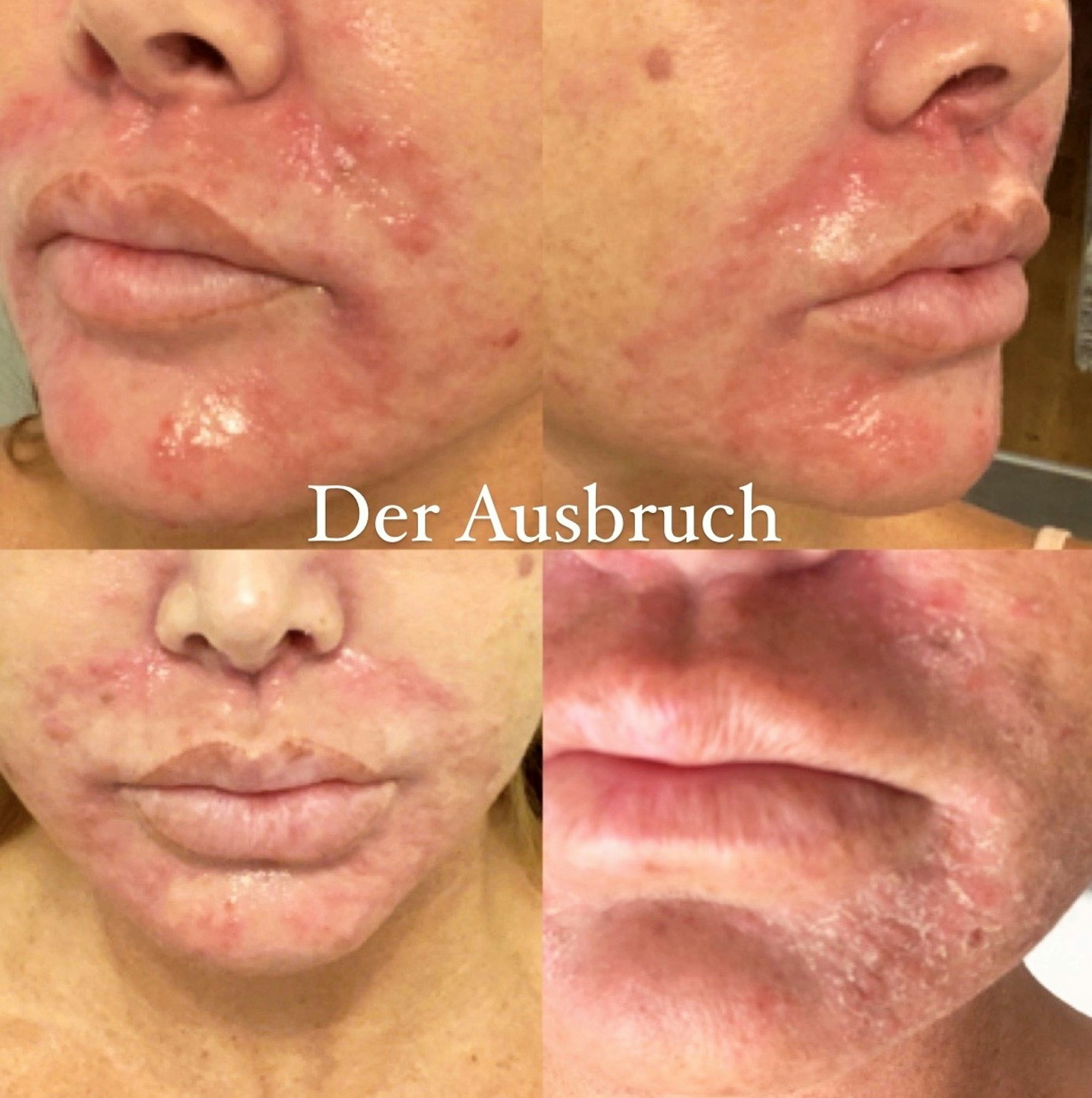 Lisha_ausbruch_16092020