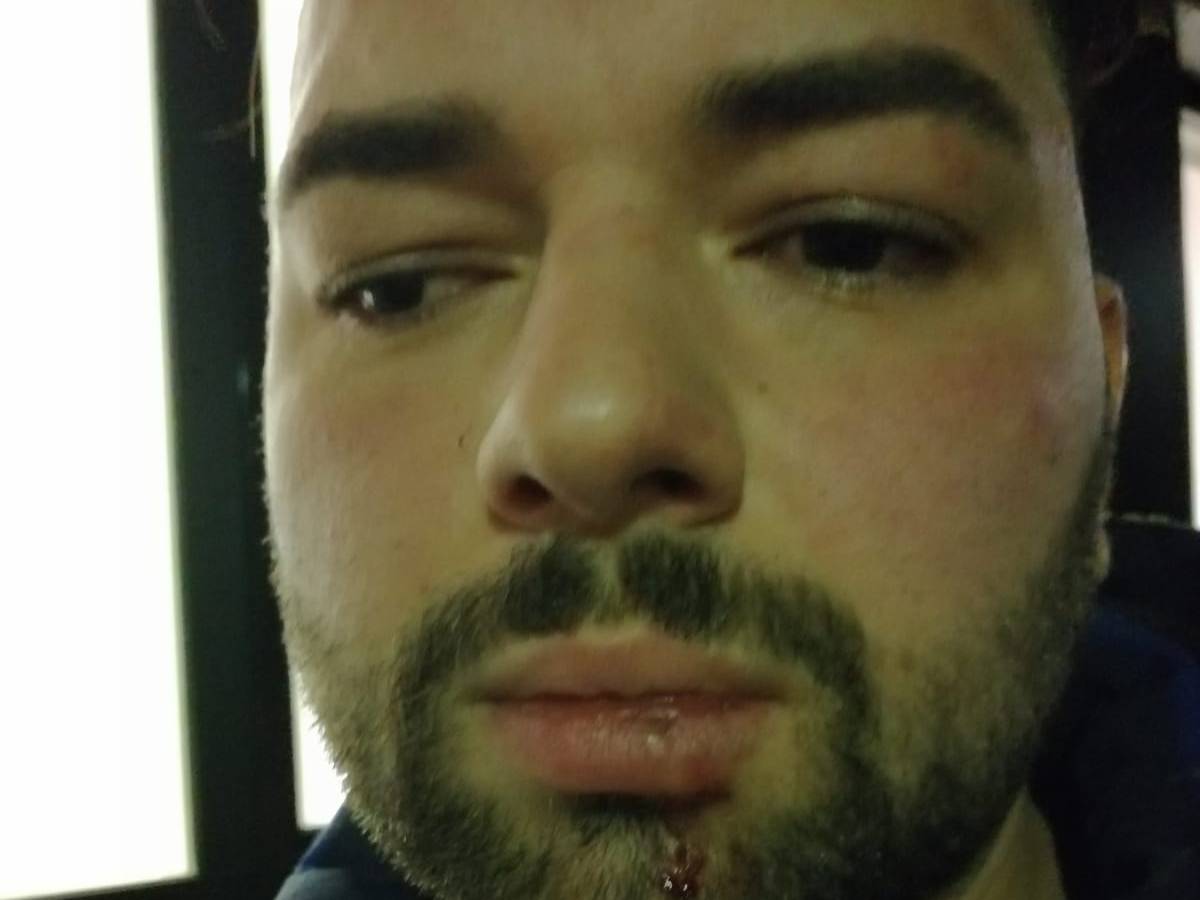 Der Kölner Yüksel Aker erhebt nach einem Polizeieinsatz schwere Vorwürfe gegen Polizisten, die ihn geschlagen haben sollen.