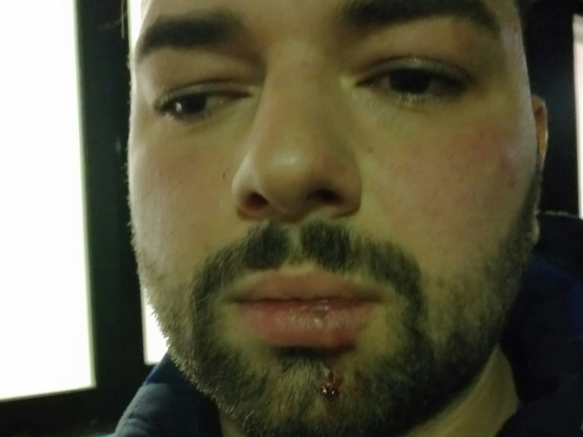 Der Kölner Yüksel Aker erhebt nach einem Polizeieinsatz schwere Vorwürfe gegen Polizisten, die ihn geschlagen haben sollen.