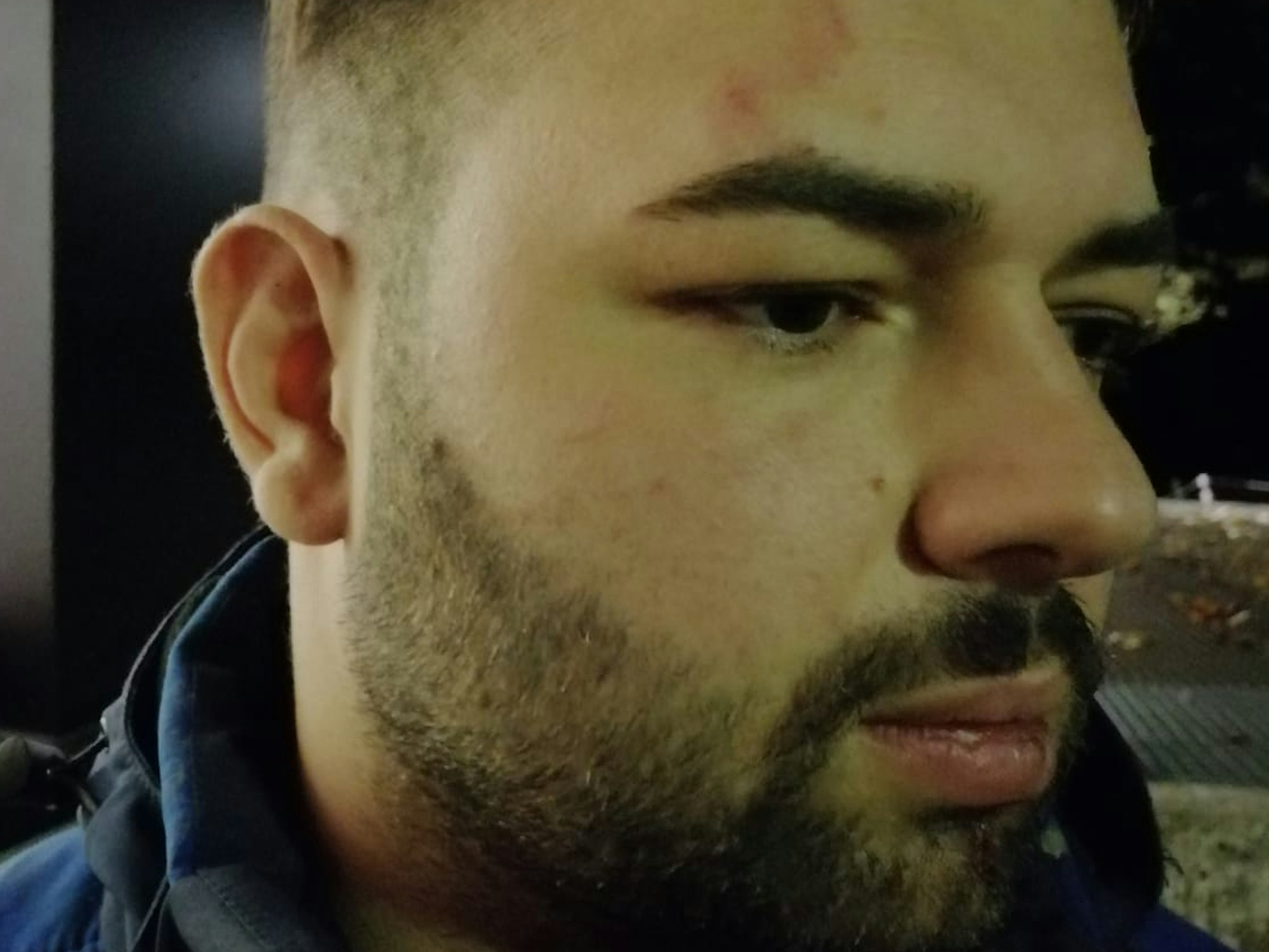 Der Kölner Yüksel Aker wurde bei dem Polizeieinsatz auf seinem Firmengelände verletzt