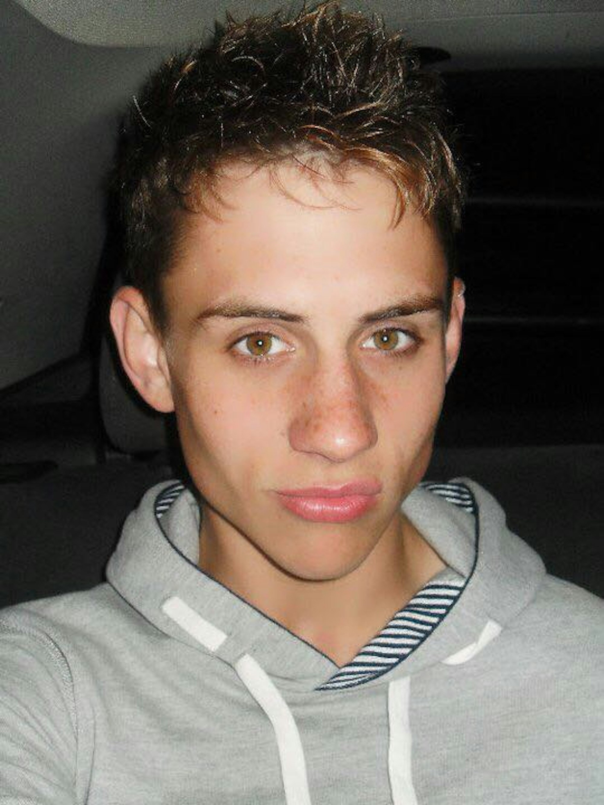 Auf diesem Foto sieht man deutlich, dass Pat durch seine Essstörung schon viel an Gewicht verloren hatte.