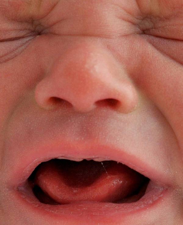 Baby schreit_Symbol