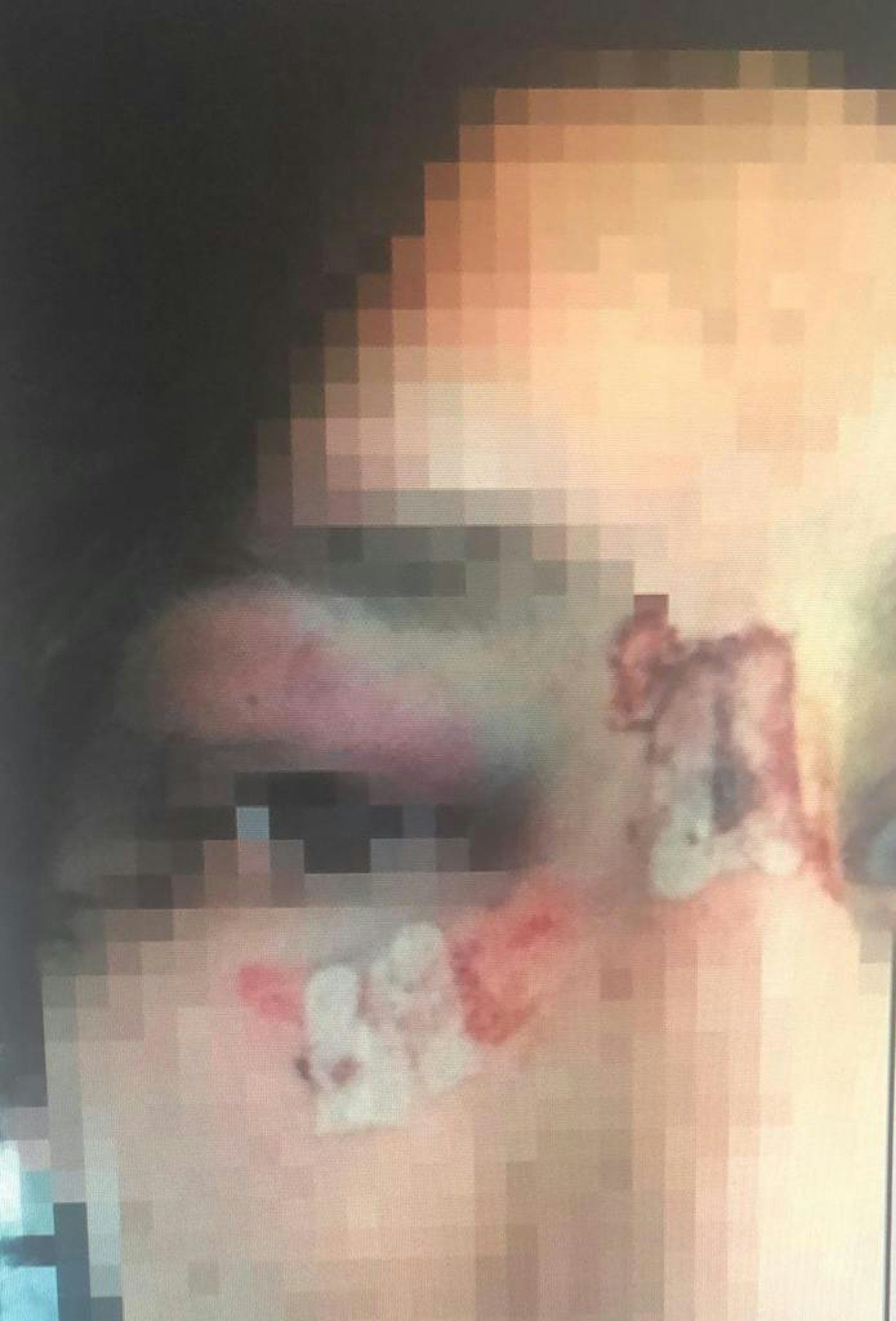 Angriff_chorweiler_05_07_2019 (3)