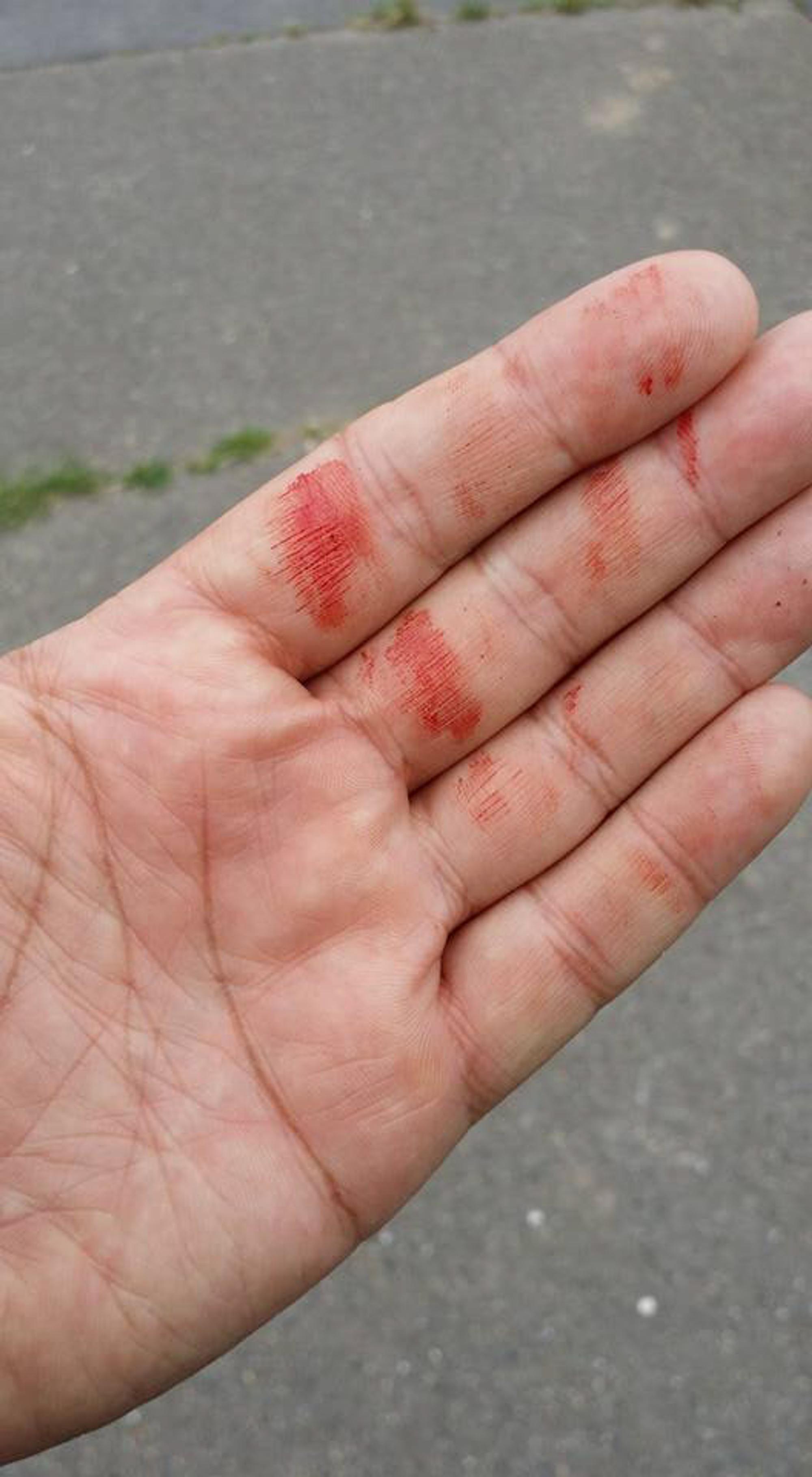 Bussard Hand