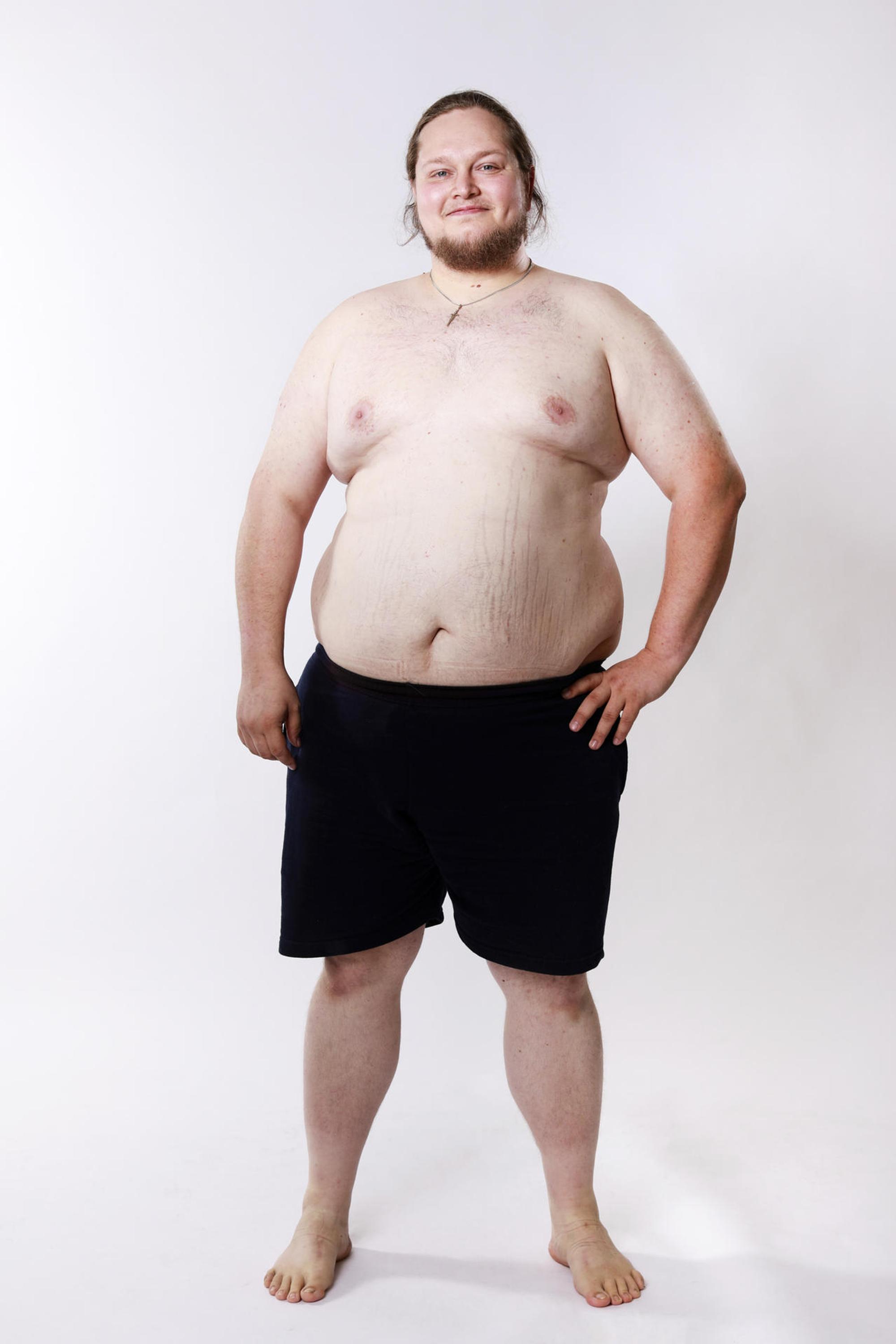 Biggest_Loser_Robin