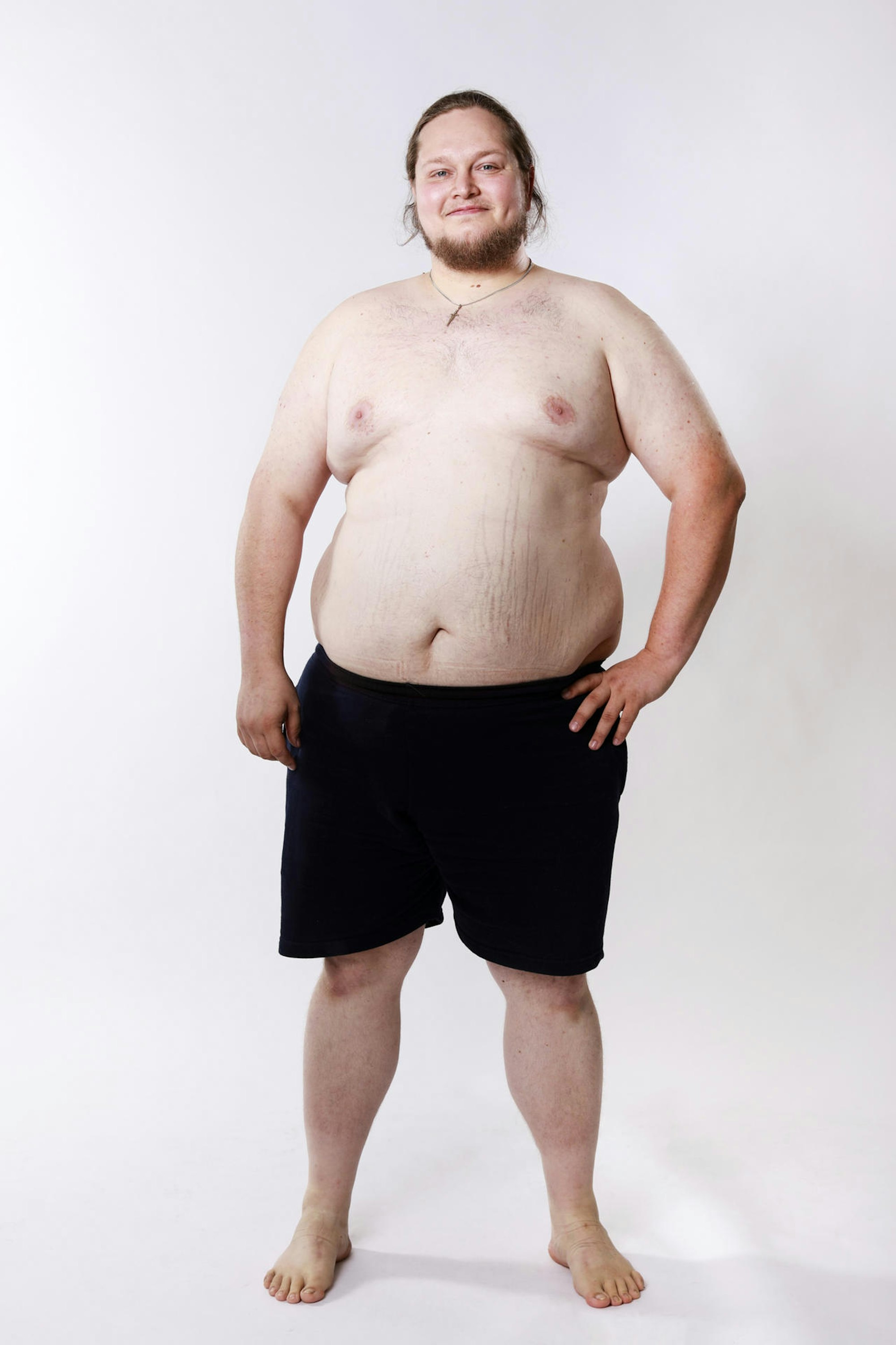 Biggest_Loser_Robin